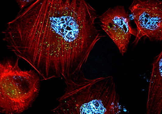 UNRC: Desarrollan nanopartículas que logran matar células cancerígenas