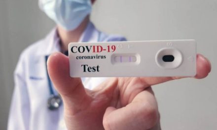 Covid-19: ya se vendieron más de 19 mil autotest y casi el 30% dio positivo
