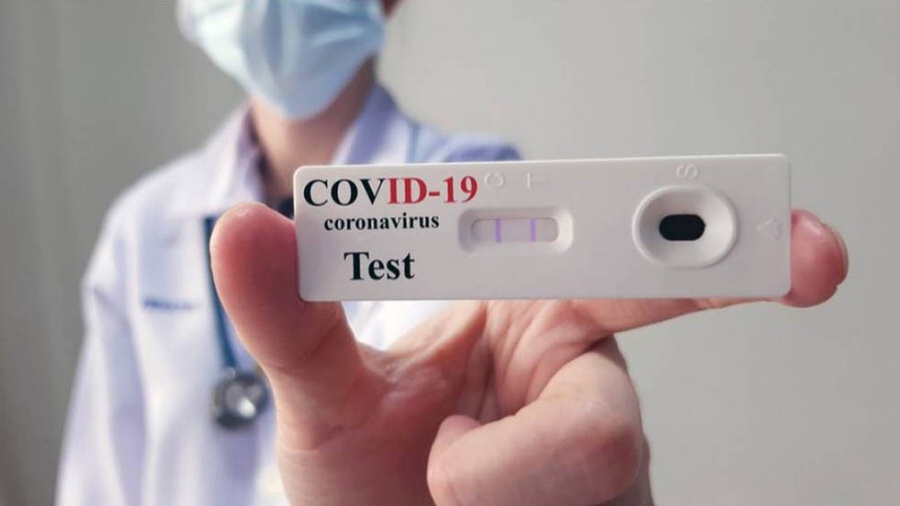 Covid-19: ya se vendieron más de 19 mil autotest y casi el 30% dio positivo