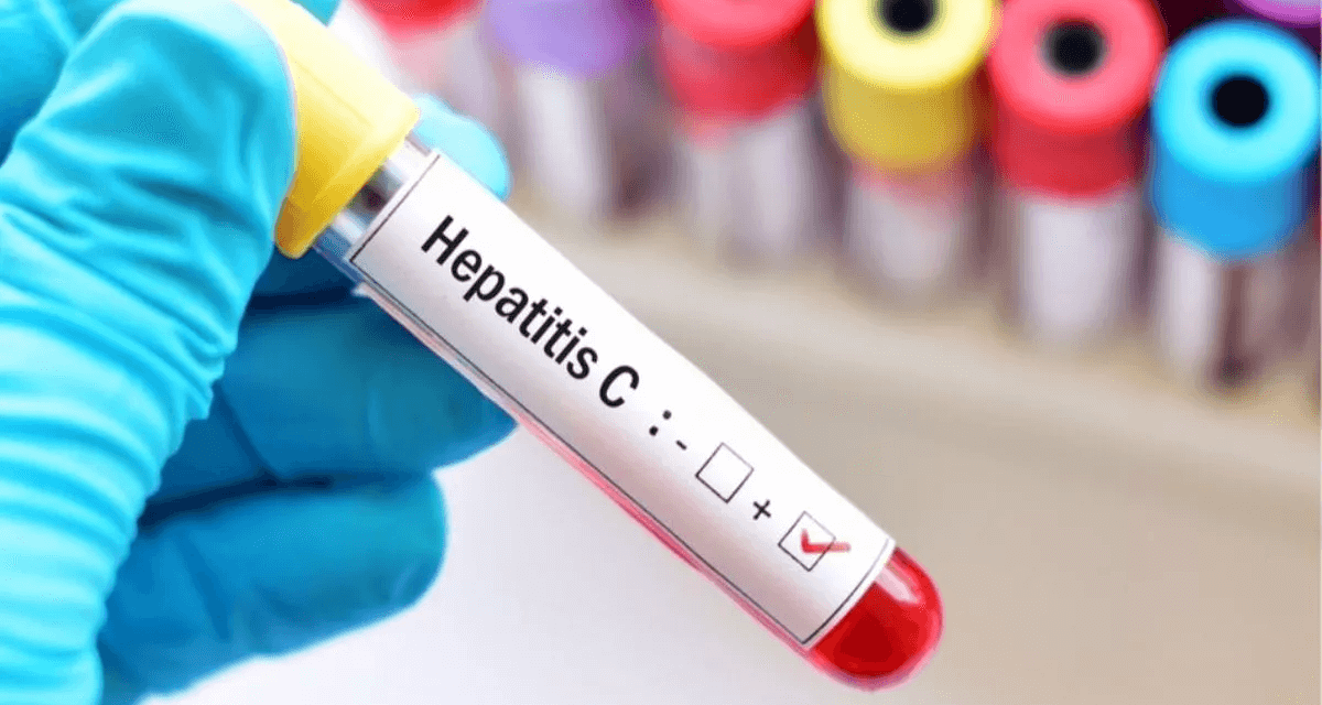 La Anmat autorizó una prueba rápida que detecta el virus de la hepatitis C